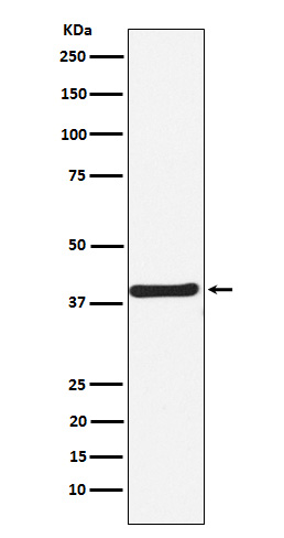 1 - Anti-CaMKI Rabbit Monoclonal Antibody ABO15550