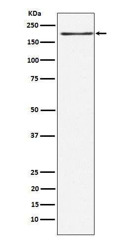 1 - Anti-LRP6 Rabbit Monoclonal Antibody ABO15551