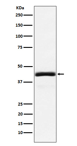 1 - Anti-NEK2 Rabbit Monoclonal Antibody ABO15556