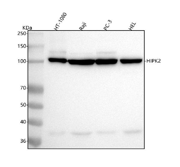 1 - Anti-HIPK2 Rabbit Monoclonal Antibody ABO15557