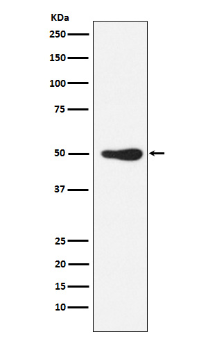 1 - Anti-FOXL2 Rabbit Monoclonal Antibody ABO15562