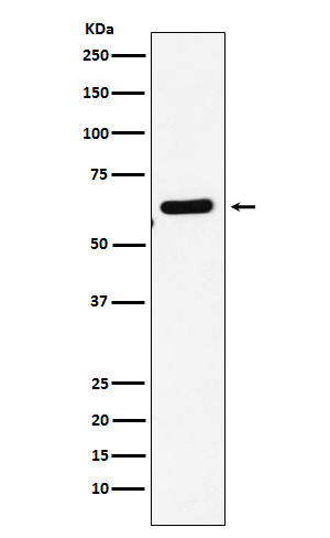 1 - Anti-EHD1 Rabbit Monoclonal Antibody ABO15563