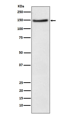 1 - Anti-NPC1L1 Rabbit Monoclonal Antibody ABO15565