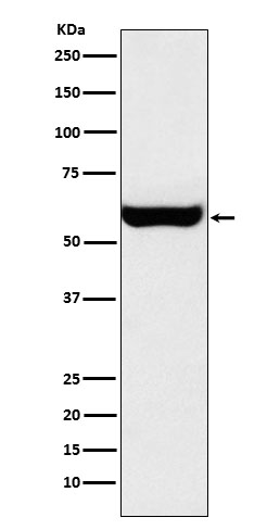 1 - Anti-Monoamine Oxidase A Rabbit Monoclonal Antibody ABO15568