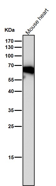 1 - Anti-Monoamine Oxidase A Rabbit Monoclonal Antibody ABO15568