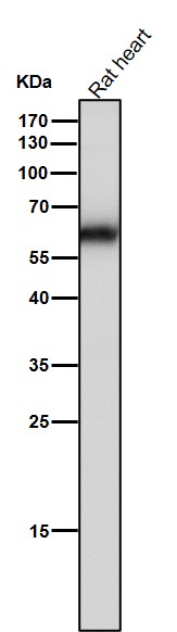 1 - Anti-Monoamine Oxidase A Rabbit Monoclonal Antibody ABO15568