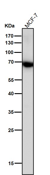 1 - Anti-Monoamine Oxidase A Rabbit Monoclonal Antibody ABO15568