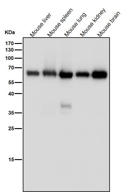 1 - Anti-Monoamine Oxidase A Rabbit Monoclonal Antibody ABO15568