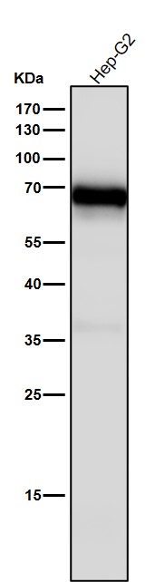 1 - Anti-Monoamine Oxidase A Rabbit Monoclonal Antibody ABO15568