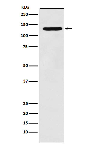 1 - Anti-PCB Rabbit Monoclonal Antibody ABO15570