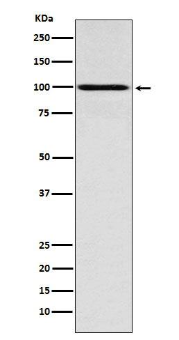 1 - Anti-IFNGR1 Rabbit Monoclonal Antibody ABO15571