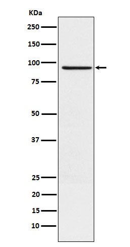 1 - Anti-RAP1GAP Rabbit Monoclonal Antibody ABO15572