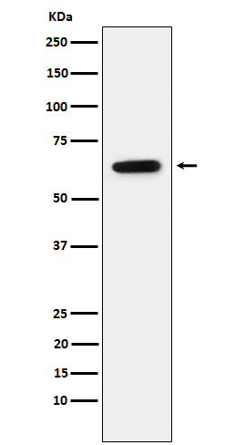 1 - Anti-Estrogen Receptor alpha Rabbit Monoclonal Antibody ABO15573