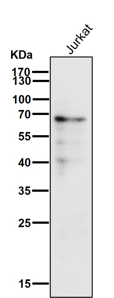 1 - Anti-Estrogen Receptor alpha Rabbit Monoclonal Antibody ABO15573