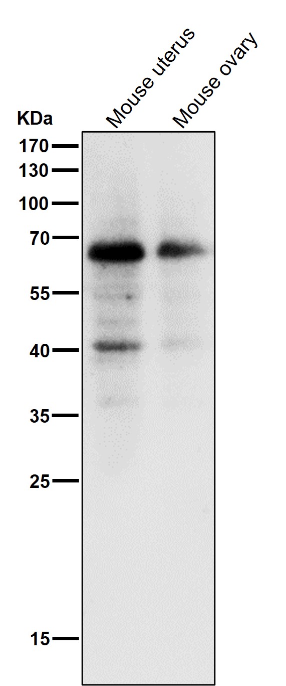 1 - Anti-Estrogen Receptor alpha Rabbit Monoclonal Antibody ABO15573
