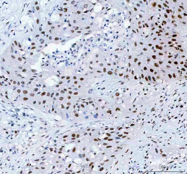 2 - Anti-HSF1 Rabbit Monoclonal Antibody ABO15574