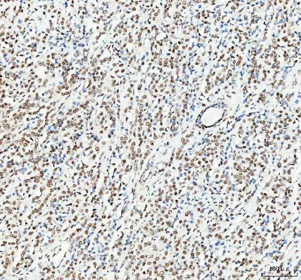 2 - Anti-HSF1 Rabbit Monoclonal Antibody ABO15574
