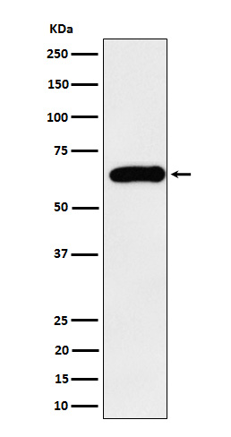 1 - Anti-SQSTM1 / p62 Rabbit Monoclonal Antibody ABO15575