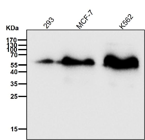 1 - Anti-SQSTM1 / p62 Rabbit Monoclonal Antibody ABO15575