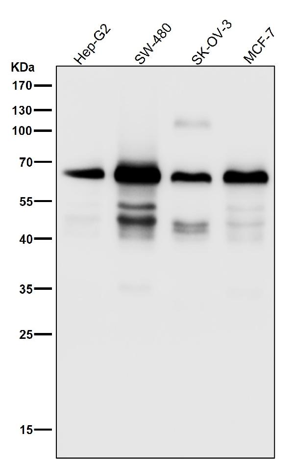 1 - Anti-SQSTM1 / p62 Rabbit Monoclonal Antibody ABO15575