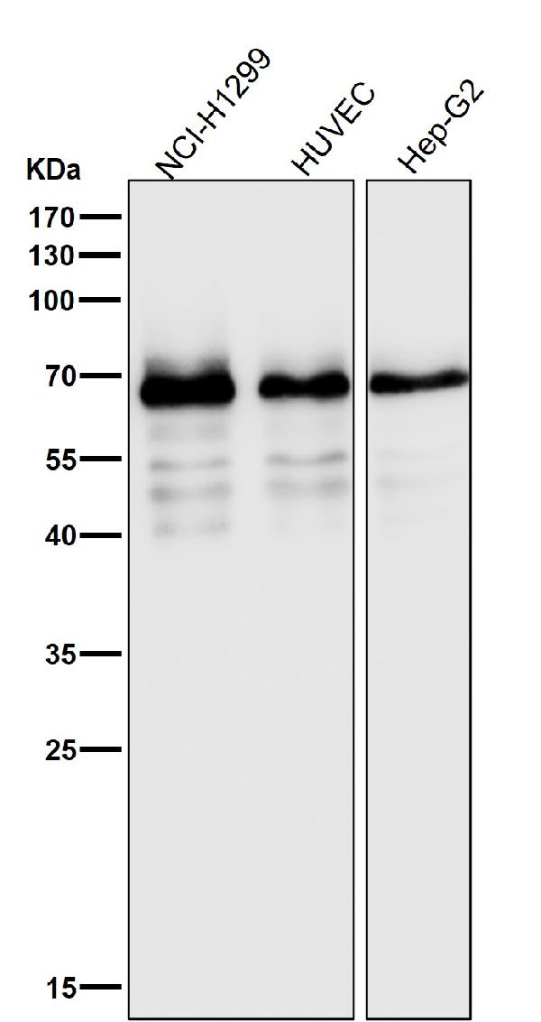 1 - Anti-SQSTM1 / p62 Rabbit Monoclonal Antibody ABO15575