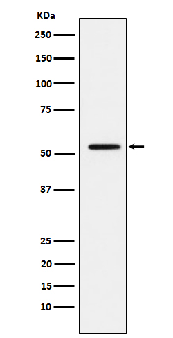 1 - Anti-MMP1 Rabbit Monoclonal Antibody ABO15576