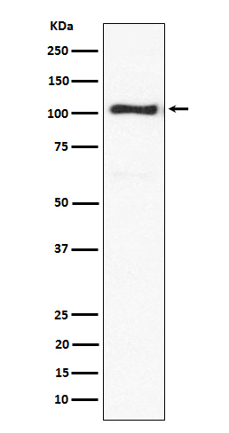 1 - Anti-ACTN3 Rabbit Monoclonal Antibody ABO15578