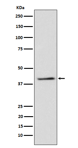 1 - Anti-TRIB3 Rabbit Monoclonal Antibody ABO15579
