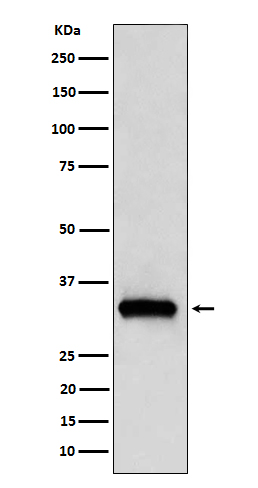 1 - Anti-NDUFAF1 Rabbit Monoclonal Antibody ABO15583