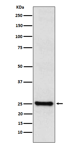 1 - Anti-TPPP Rabbit Monoclonal Antibody ABO15585