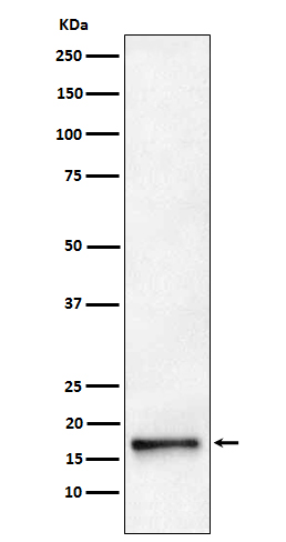 1 - Anti-AP2S1 Rabbit Monoclonal Antibody ABO15586