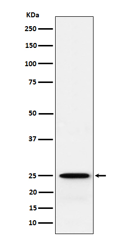 1 - Anti-GSTK1 Rabbit Monoclonal Antibody ABO15587