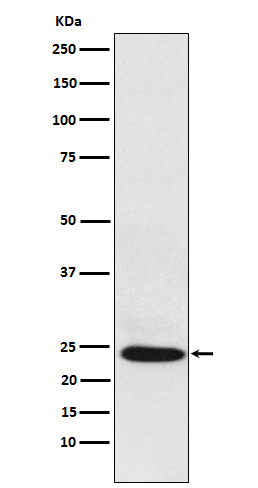 1 - Anti-BAG2 Rabbit Monoclonal Antibody ABO15591