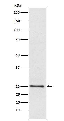 1 - Anti-Lysophospholipase 1 Rabbit Monoclonal Antibody ABO15592