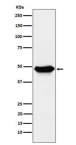 1 - Anti-ENTPD5 Rabbit Monoclonal Antibody ABO15599