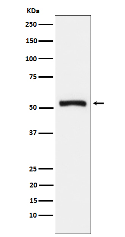 1 - Anti-Tryptophanyl tRNA synthetase Rabbit Monoclonal Antibody ABO15602