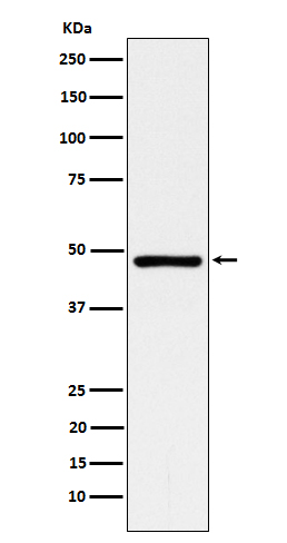 1 - Anti-ACADM Rabbit Monoclonal Antibody ABO15603