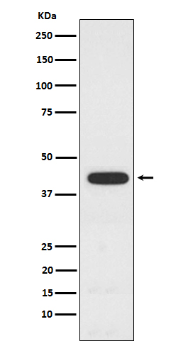 1 - Anti-PCYT1A Rabbit Monoclonal Antibody ABO15606