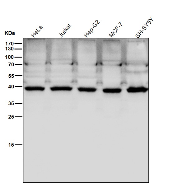 1 - Anti-PCYT1A Rabbit Monoclonal Antibody ABO15606