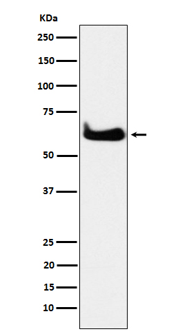 1 - Anti-TCP1 alpha Rabbit Monoclonal Antibody ABO15608