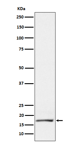 1 - Anti-GCDFP 15 Rabbit Monoclonal Antibody ABO15609