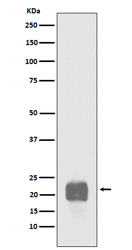 1 - Anti-Cripto1 Rabbit Monoclonal Antibody ABO15610