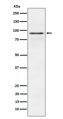 1 - Anti-RSK1 p90 Rabbit Monoclonal Antibody ABO15612