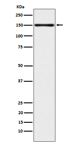 1 - Anti-CLSTN1 Rabbit Monoclonal Antibody ABO15613