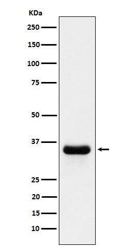 1 - Anti-PSMD14 Rabbit Monoclonal Antibody ABO15614