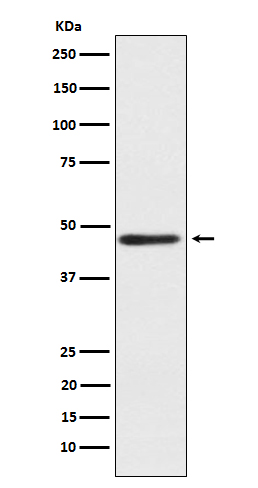1 - Anti-ENTPD5 Rabbit Monoclonal Antibody ABO15615