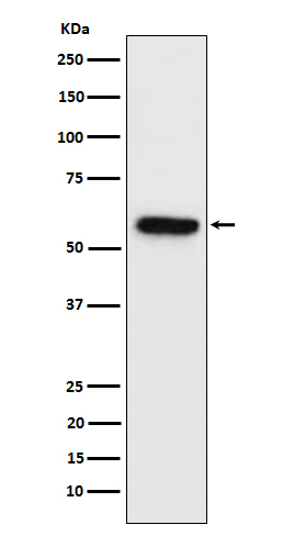 1 - Anti-Synapsin II Rabbit Monoclonal Antibody ABO15617