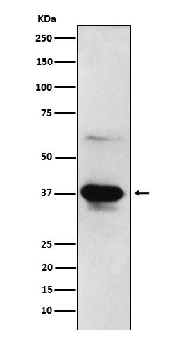 1 - Anti-ICAD Rabbit Monoclonal Antibody ABO15620