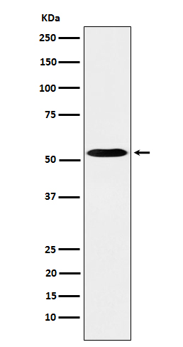 1 - Anti-PKA R2 Rabbit Monoclonal Antibody ABO15621