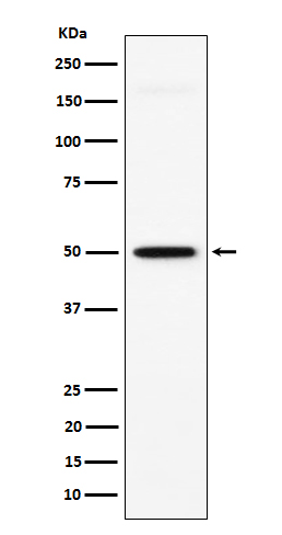 1 - Anti-GPA33 Rabbit Monoclonal Antibody ABO15622